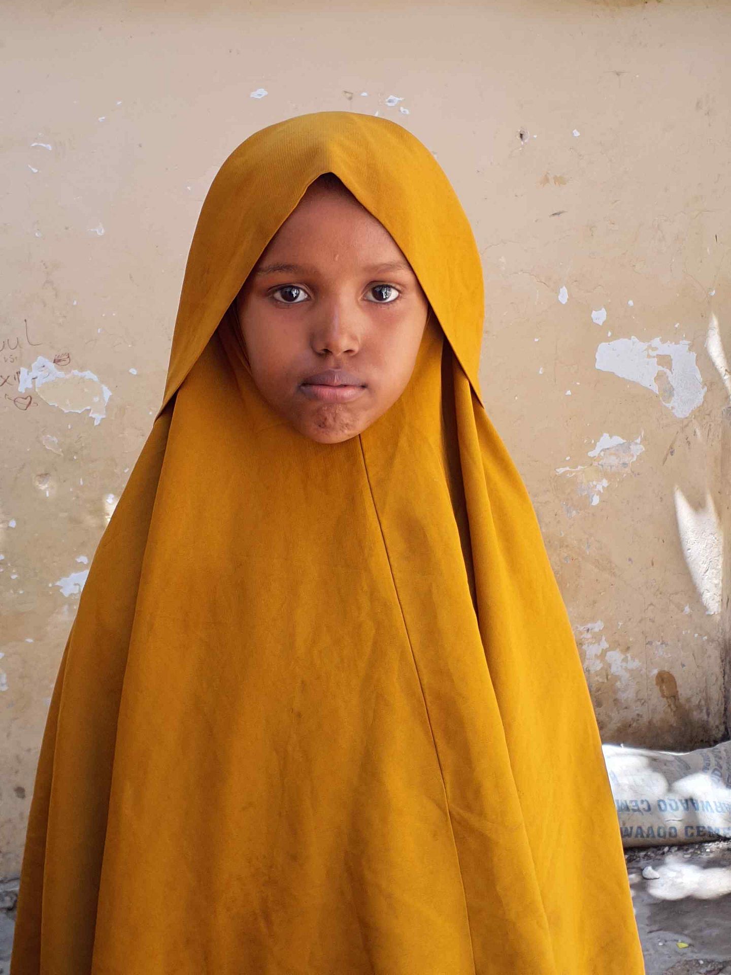 Human Appeal Orphan - Imran Shire