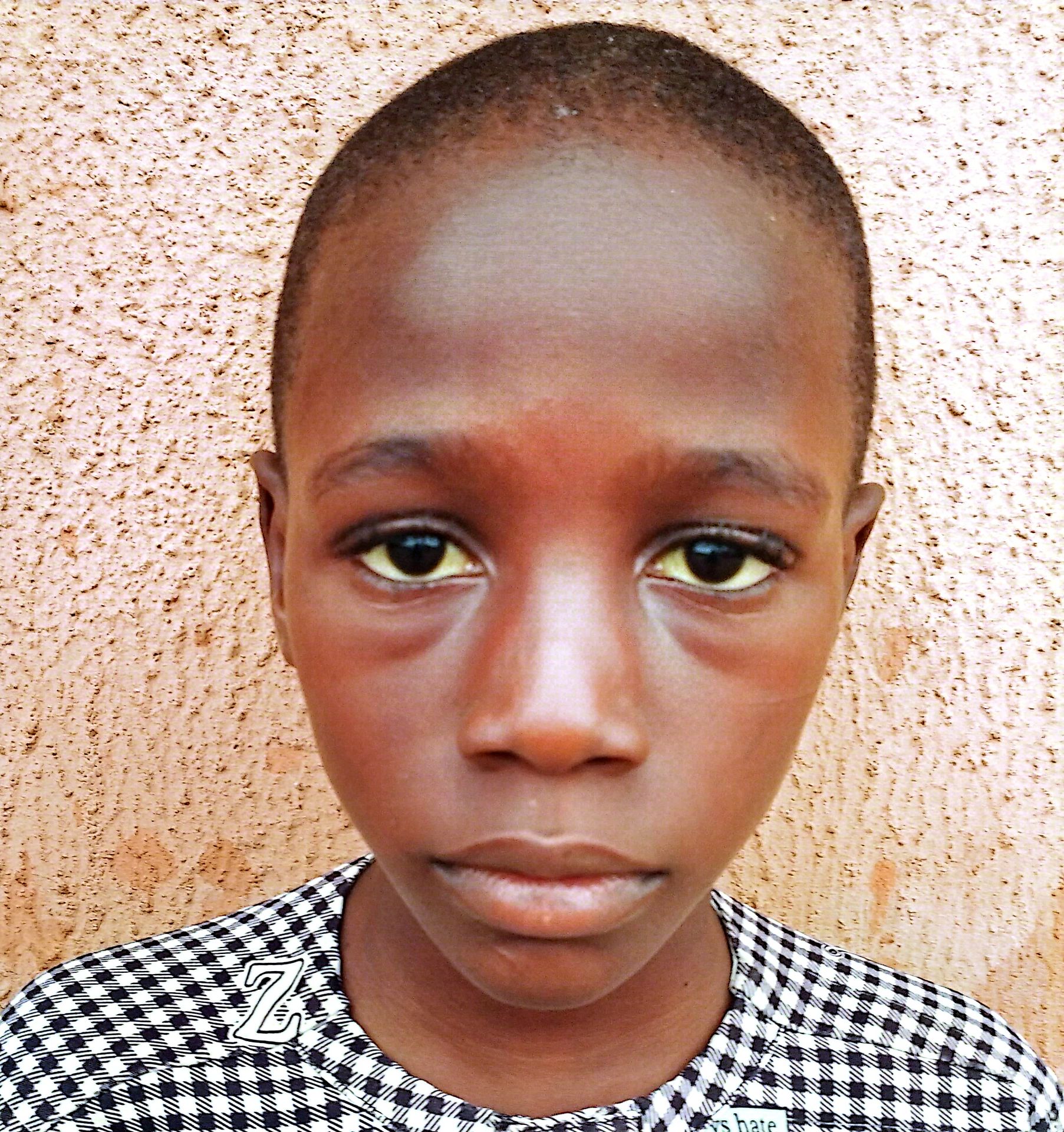 Human Appeal Orphan - Awwal