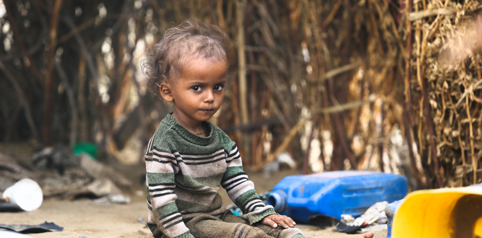 Malnutritioned child in Yemen